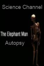 Watch Science Channel Elephant Man Autopsy 123MoviesFree