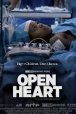 Watch Open Heart 123MoviesFree