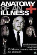 Watch Anatomy of an Illness 123MoviesFree