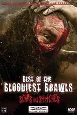 Watch TNA Wrestling: Best of the Bloodiest Brawls - Scars and Stitches 123MoviesFree