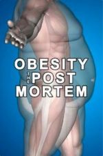 Watch Obesity: The Post Mortem 123MoviesFree