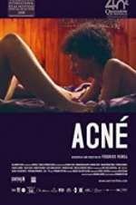 Watch Acné 123MoviesFree